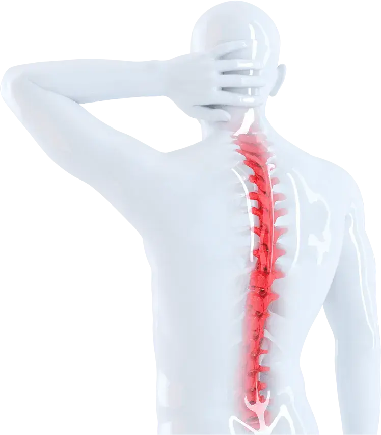 Posture Correction