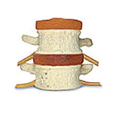 Spine Phase 1