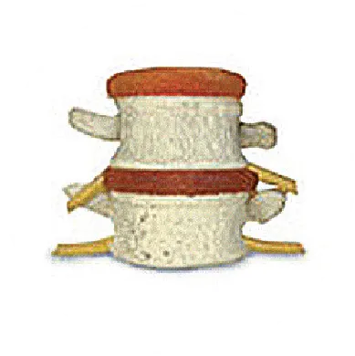 Spine Phase 2