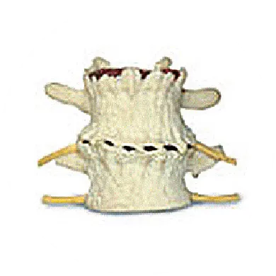 Spine Phase 4