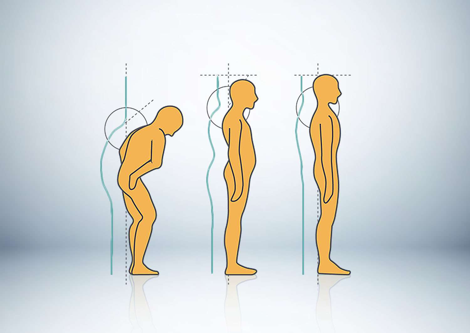 Advanced Bio Structrual Correction – ABC™
