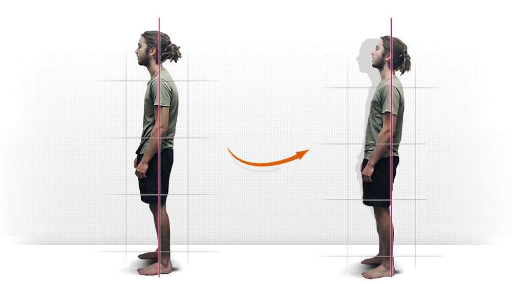 Learning the Importance of Good Posture at Clinic 27