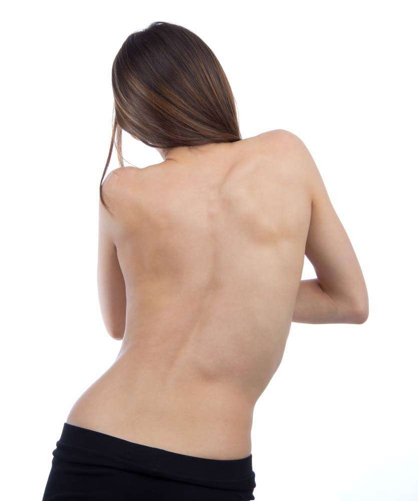 How Chiropractors Can Treat Scoliosis Symptoms