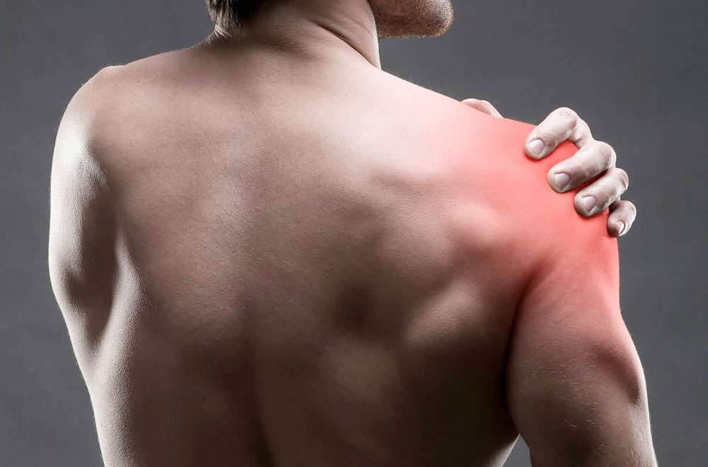 Understanding Thoracic Outlet Syndrome